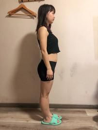 27岁小姐姐做完腹部吸脂50天，朋友说我是女神级别的了！(图2)