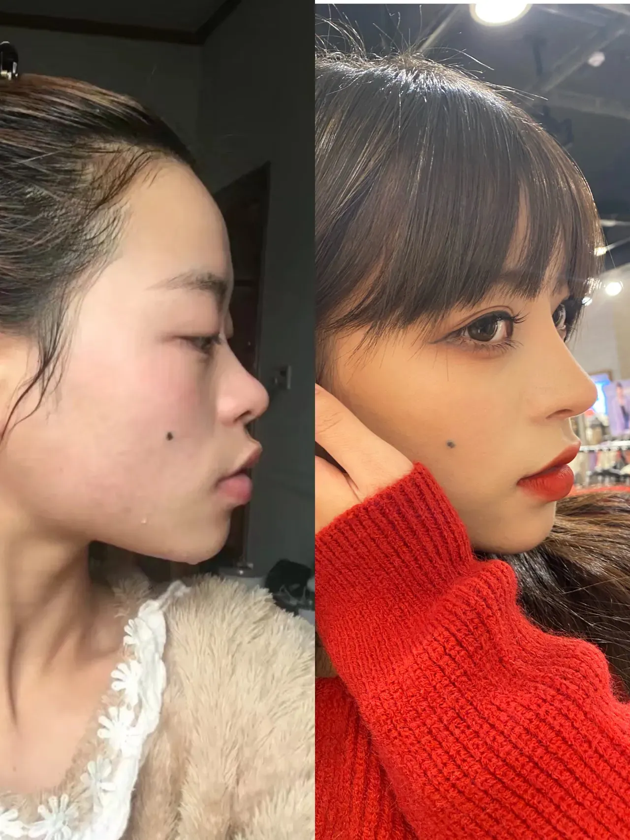 做了眼睛和鼻子真的直接变女神(图7)