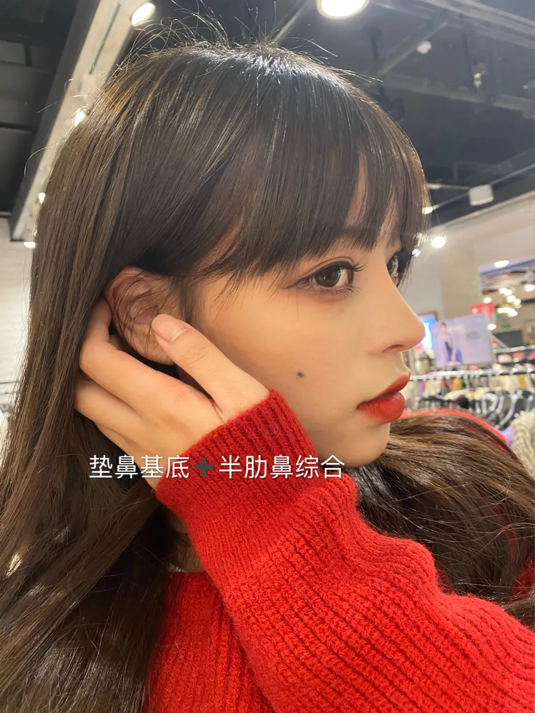 做了眼睛和鼻子真的直接变女神(图5)