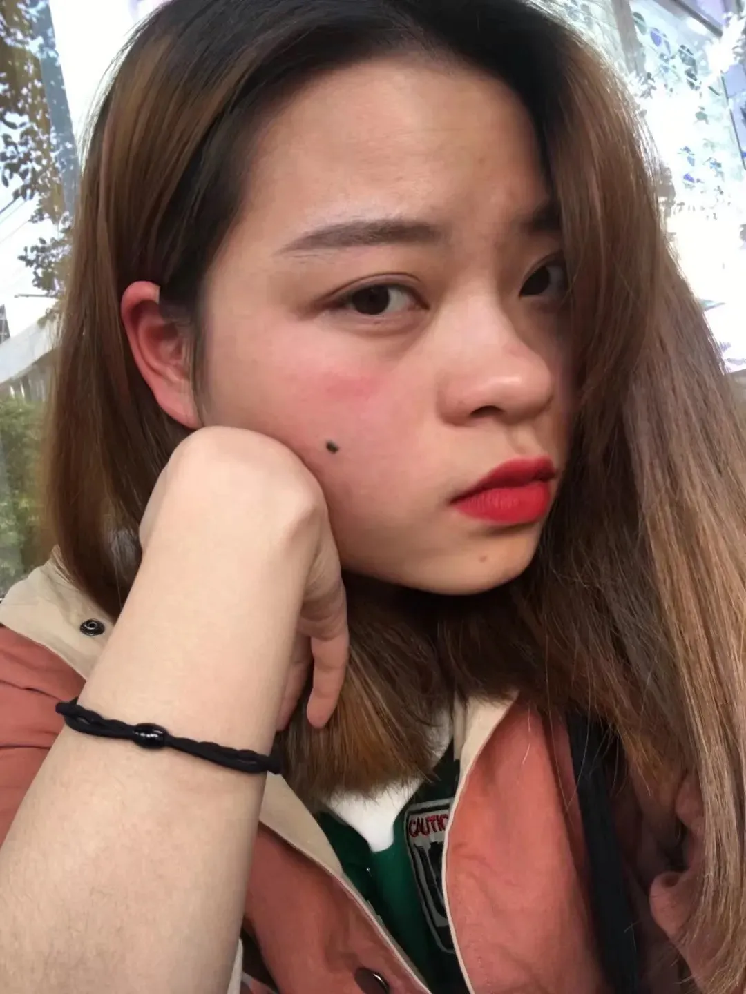 做了眼睛和鼻子真的直接变女神(图4)