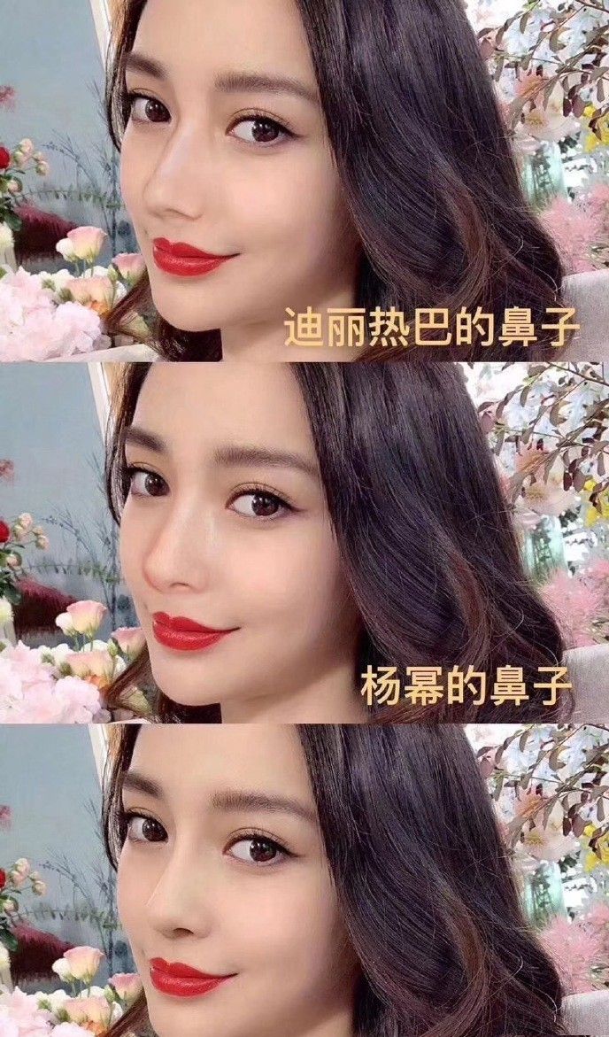 安格润整形医院鼻整形活动(图1)