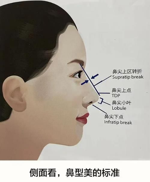 隆鼻选什么材料好？(图1)