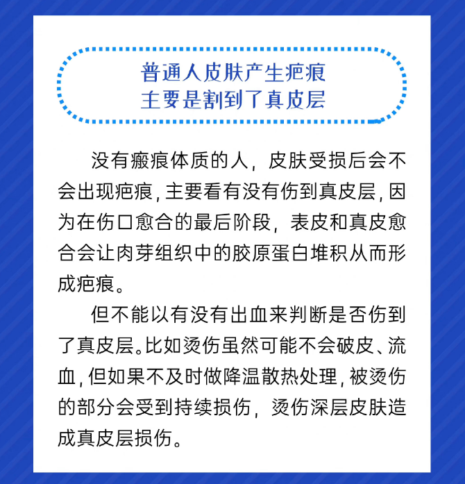 郑州安格润讲解怎么判断你是不是疤痕体质(图2)