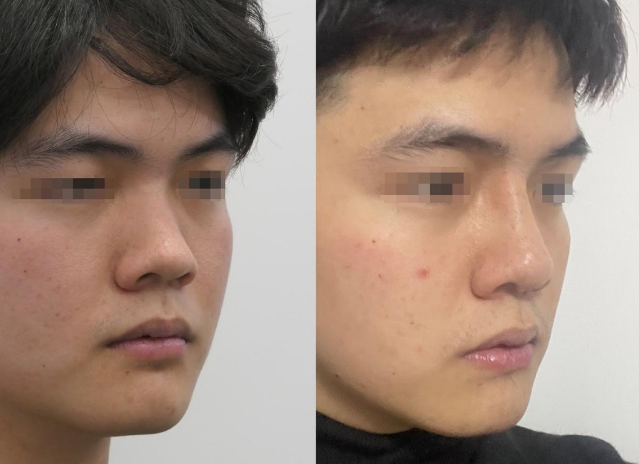郑州星帜美歌提醒作为一名普通男生该不该整容？(图2)